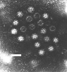 Č: Astroviridae ASTROVIRY R: Mamastrovirus savčí (lidské HAstV 1-8) R: Avastrovirus ptačí neobalené RNA viry v el.