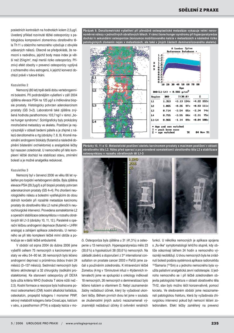 Obecně se předpokládá, že nemocní s nadváhou, jejichž body mass index je větší než 25 kg/m 2, mají menší riziko osteoporózy.