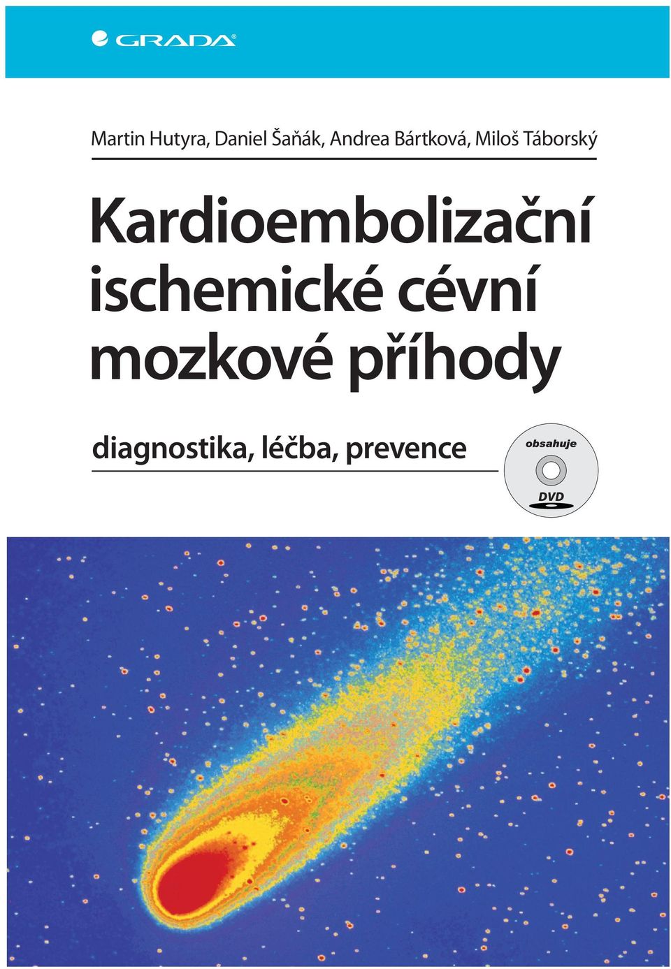 cévní mozkové příhody diagnostika, léčba, prevence Kardioembolizační ischemické