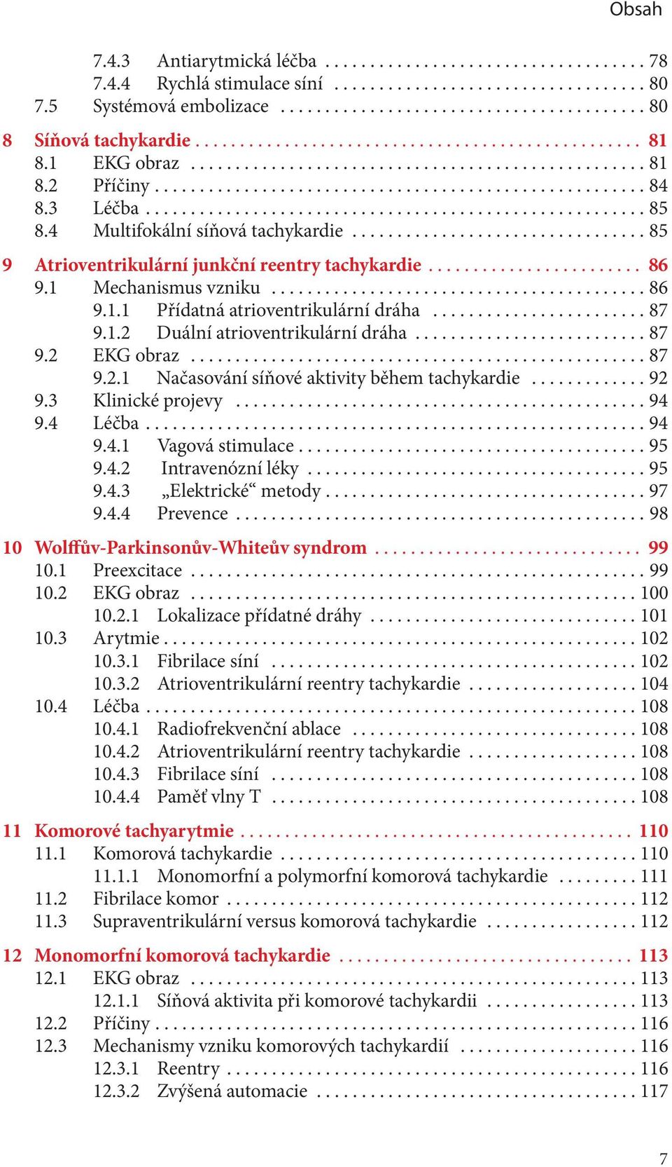 ..87 9.2 EKG obraz...87 9.2.1 Načasování síňové aktivity během tachykardie...92 9.3 Klinické projevy...94 9.4 Léčba...94 9.4.1 Vagová stimulace...95 9.4.2 Intravenózní léky...95 9.4.3 Elektrické metody.