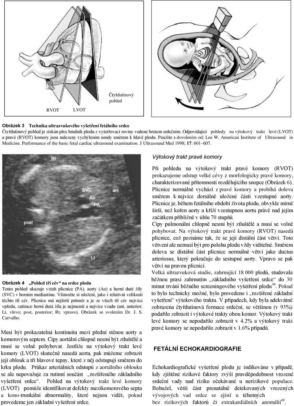 American Institute of Ultrasound in Medicine. Performance of the basic fetal cardiac ultrasound examination. J Ultrasound Med 1998; 17: 601 607.