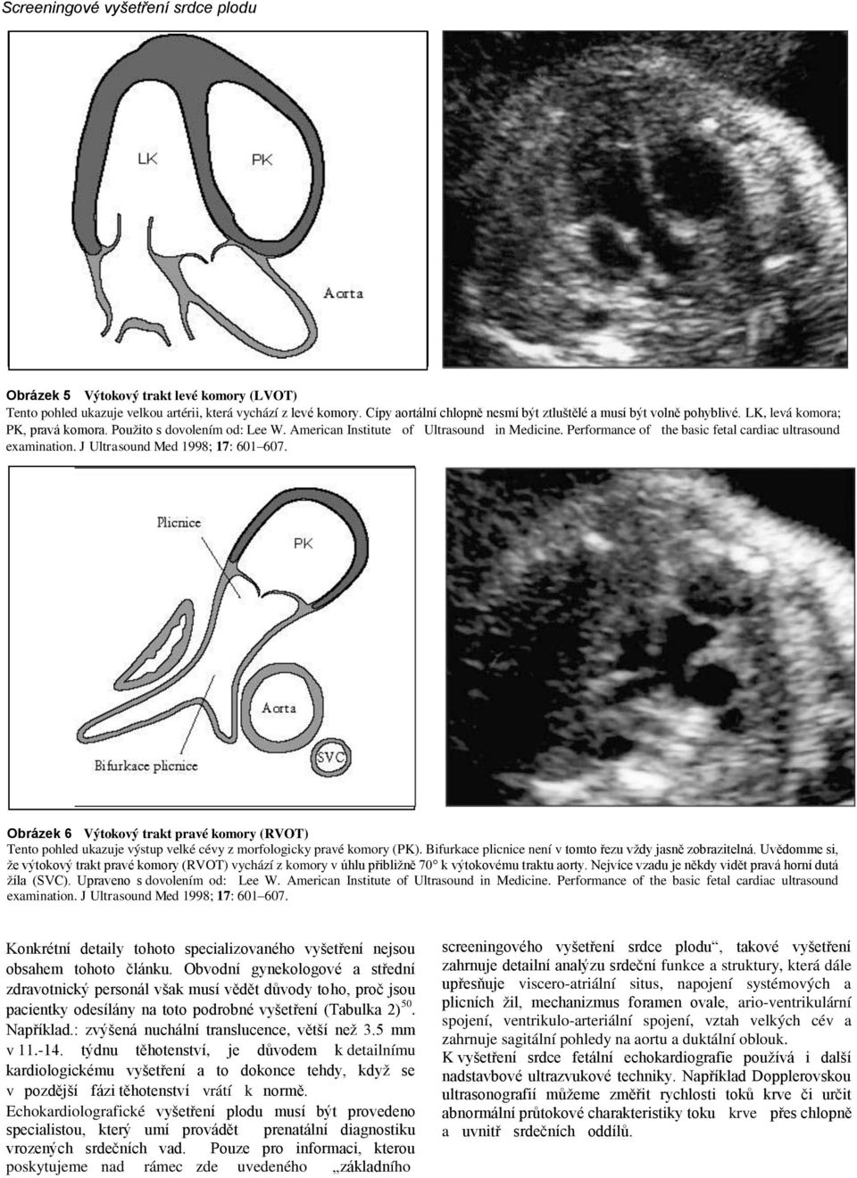 Performance of the basic fetal cardiac ultrasound examination. J Ultrasound Med 1998; 17: 601 607.