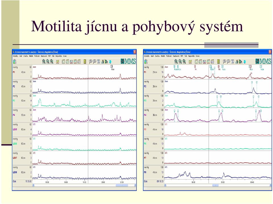 pohybový