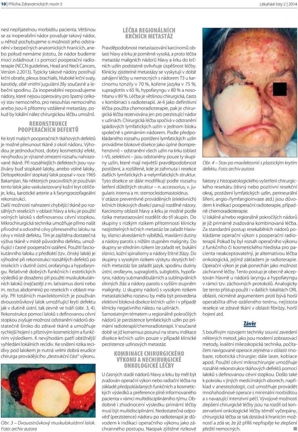 i s pomocí pooperační radioterapie (NCCN guidelines, Head and Neck Cancers, Version 2.2013).