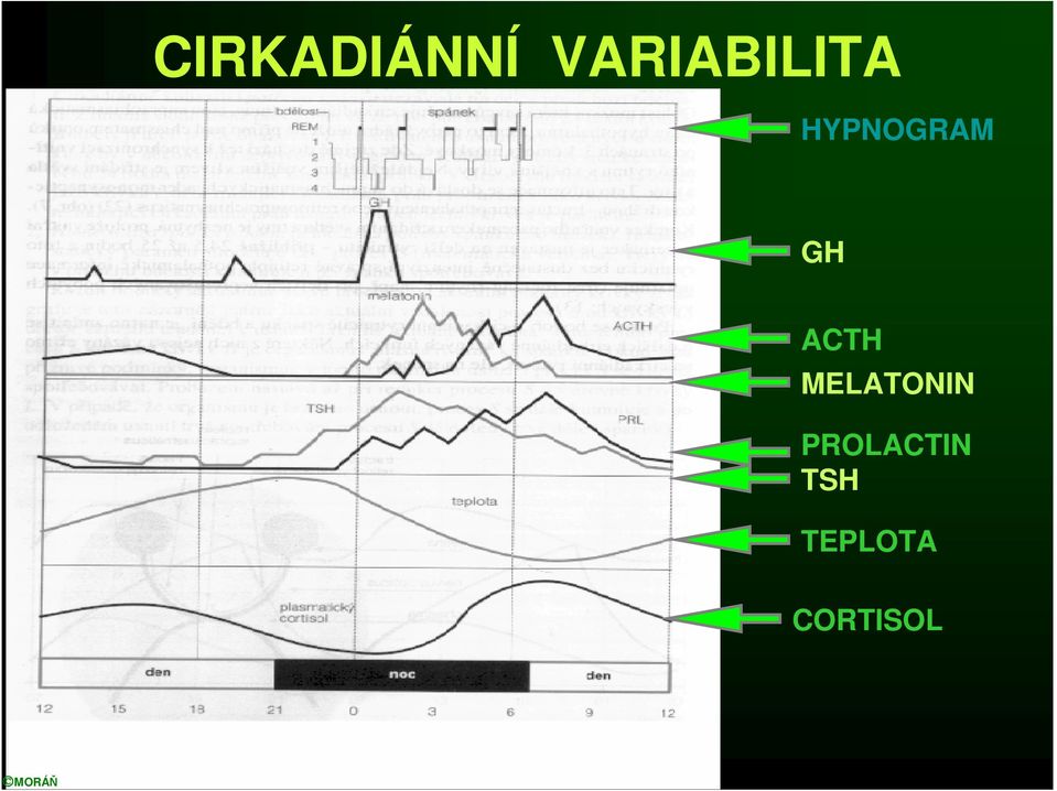 HYPNOGRAM GH ACTH