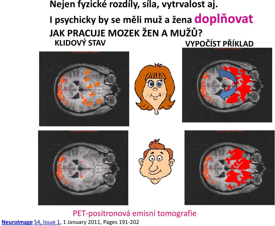 MOZEK ŽEN A MUŽŮ?