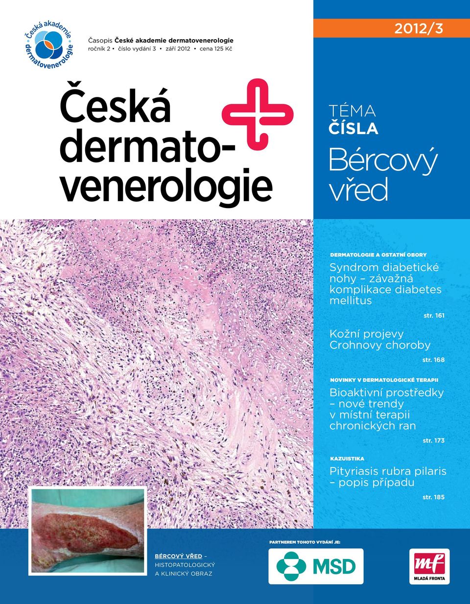 choroby str. 161 str. 168 Novinky v dermatologické terapii Bioaktivní prostředky nové trendy v místní terapii chronických ran str.