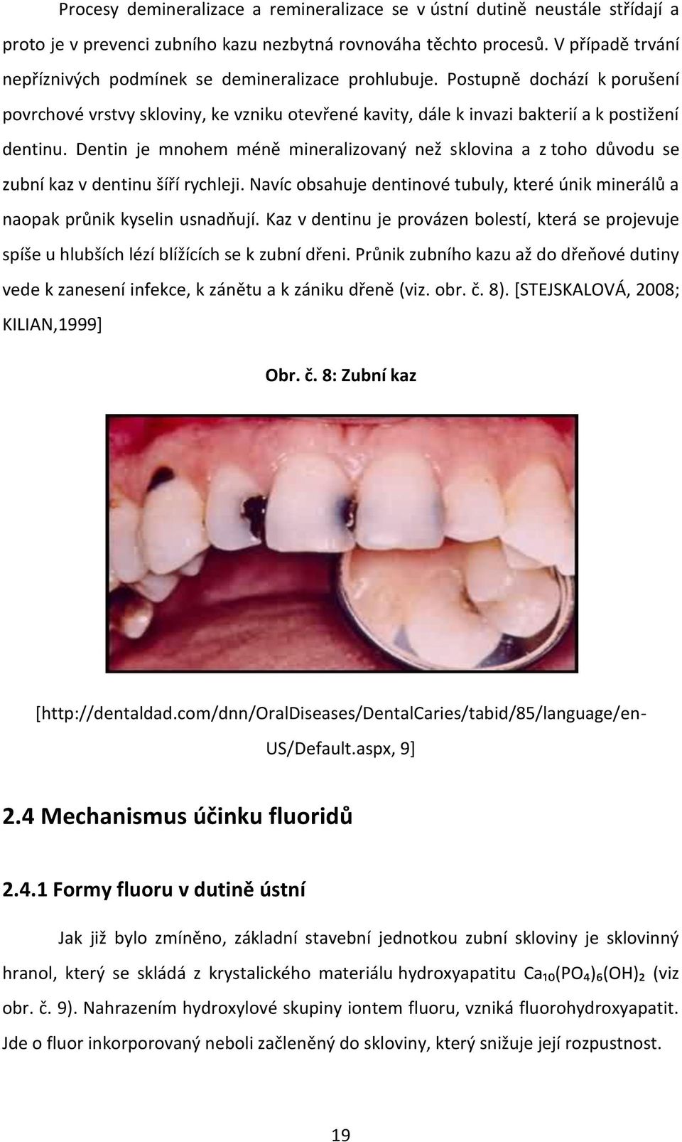 Dentin je mnohem méně mineralizovaný než sklovina a z toho důvodu se zubní kaz v dentinu šíří rychleji. Navíc obsahuje dentinové tubuly, které únik minerálů a naopak průnik kyselin usnadňují.