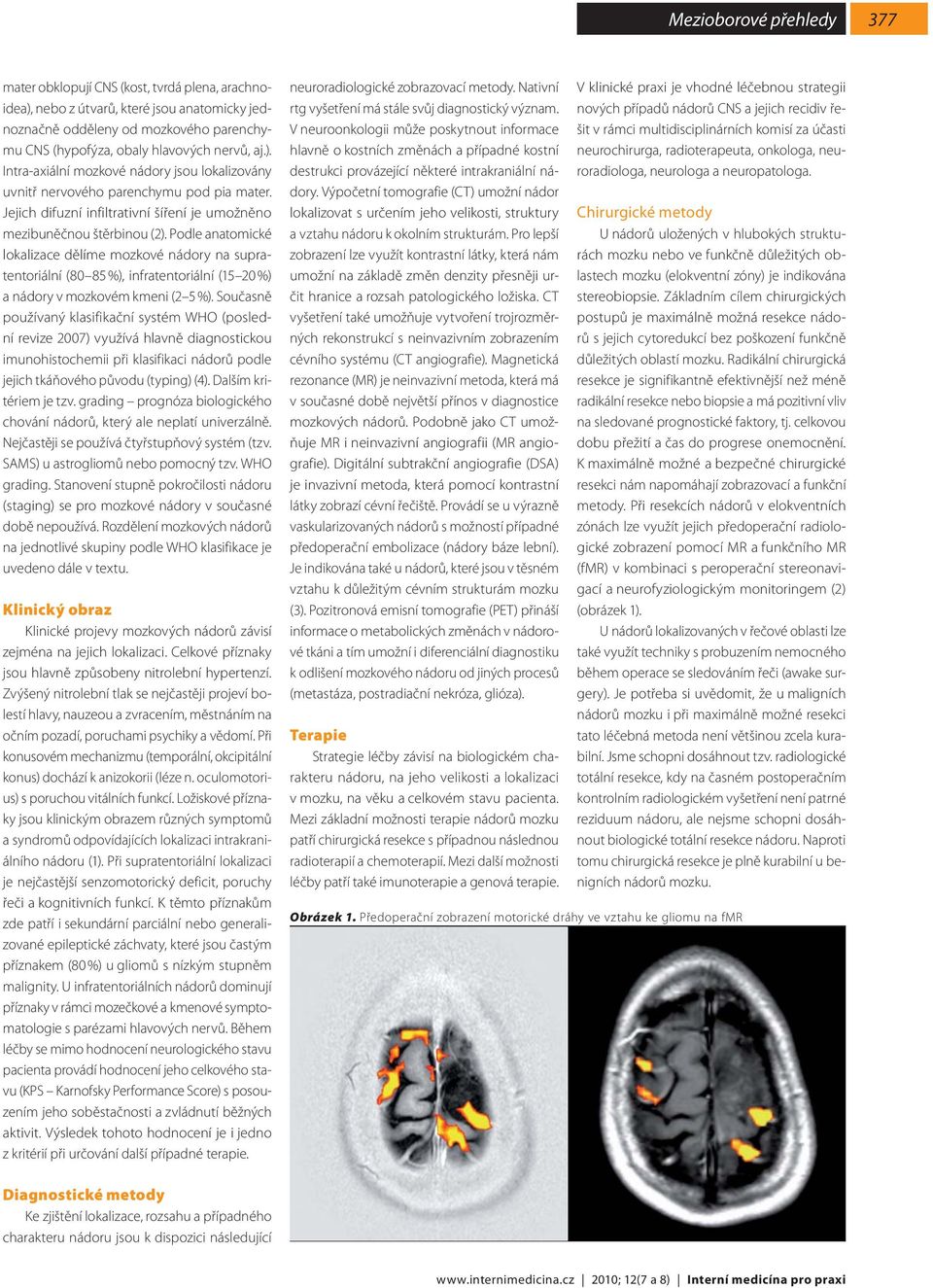 Podle anatomické lokalizace dělíme mozkové nádory na supratentoriální (80 85 %), infratentoriální (15 20 %) a nádory v mozkovém kmeni (2 5 %).