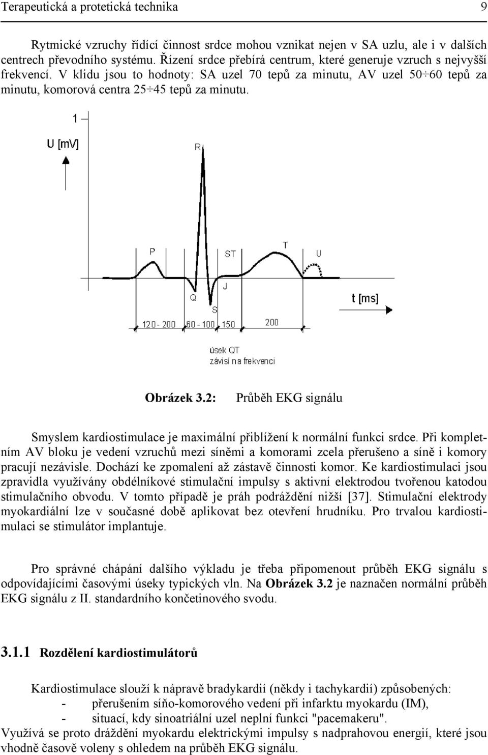 Obrázek 3.2: Průběh EKG signálu Smyslem kardiostimulace je maximální přiblížení k normální funkci srdce.