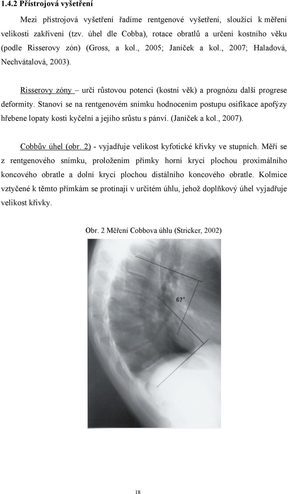 Risserovy zóny určí růstovou potenci (kostní věk) a prognózu další progrese deformity.