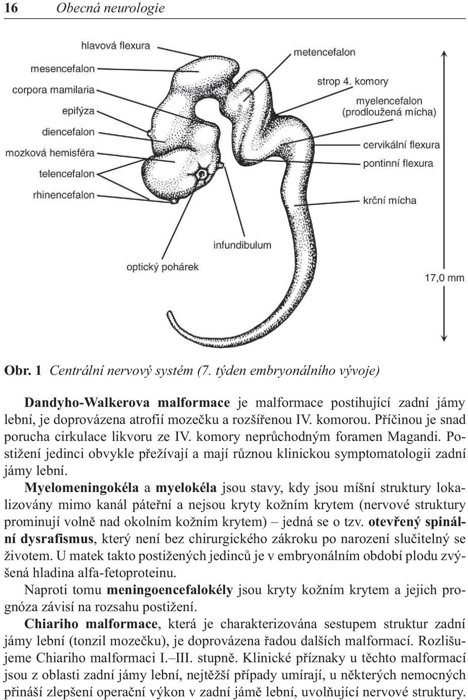 Příčinou je snad porucha cirkulace likvoru ze IV. komory neprůchodným foramen Magandi. Postižení jedinci obvykle přežívají a mají různou klinickou symptomatologii zadní jámy lební.