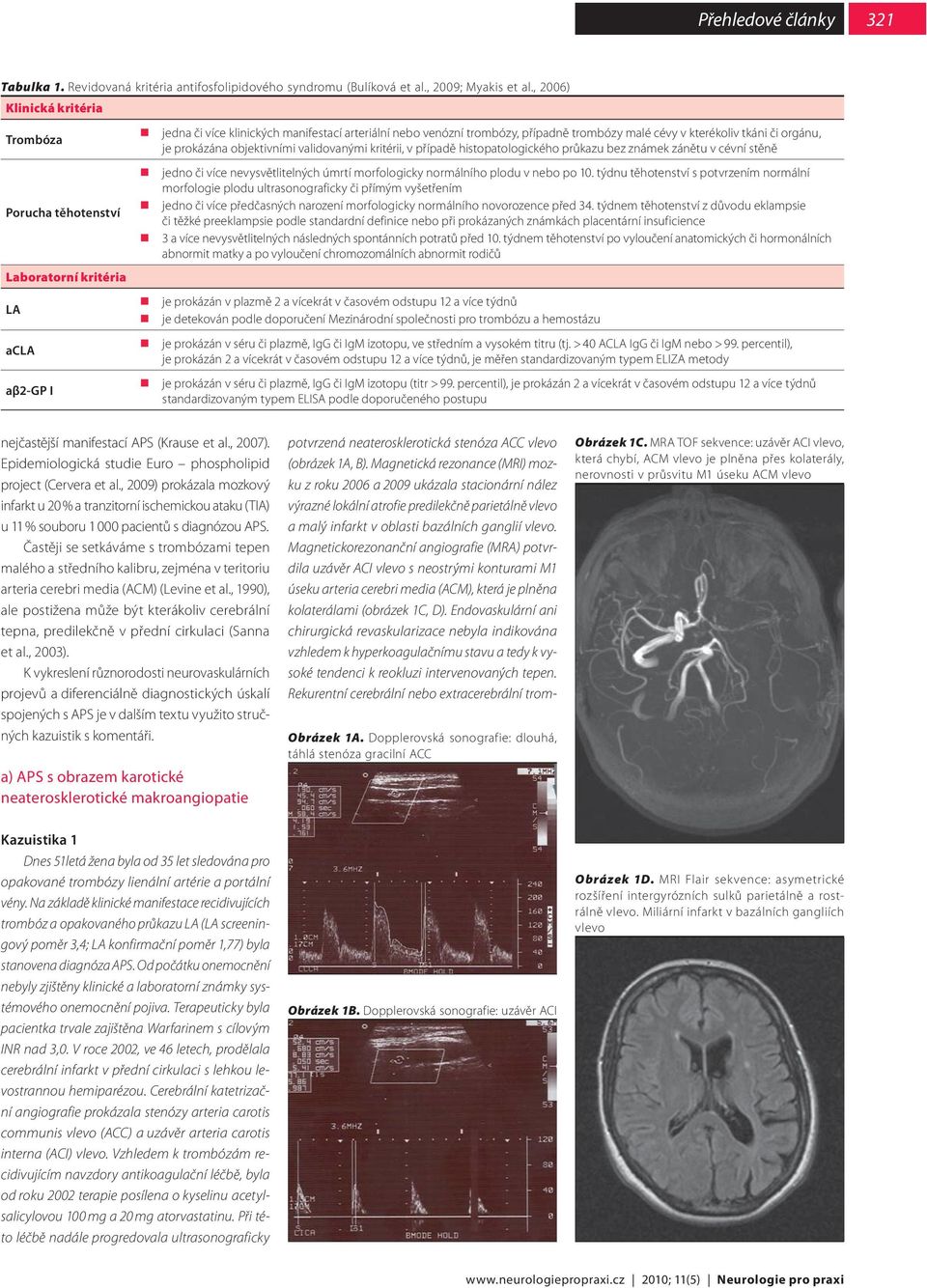 kterékoliv tkáni či orgánu, je prokázána objektivními validovanými kritérii, v případě histopatologického průkazu bez známek zánětu v cévní stěně jedno či více nevysvětlitelných úmrtí morfologicky