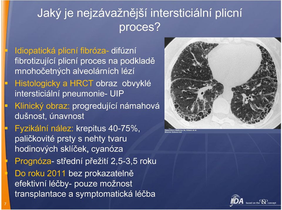 obraz obvyklé intersticiální pneumonie- UIP Klinický obraz: progredující námahová dušnost, únavnost Fyzikální nález: krepitus