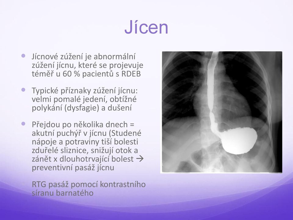 několika dnech = akutní puchýř v jícnu (Studené nápoje a potraviny tiší bolesti zduřelé sliznice,