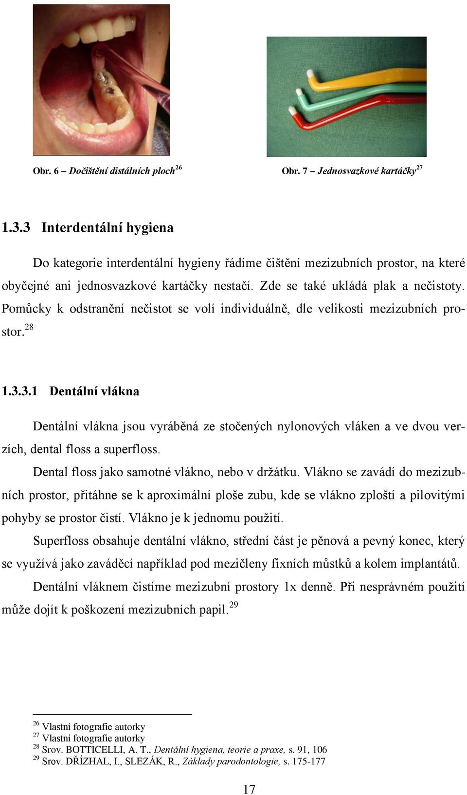 Pomůcky k odstranění nečistot se volí individuálně, dle velikosti mezizubních prostor. 28 1.3.