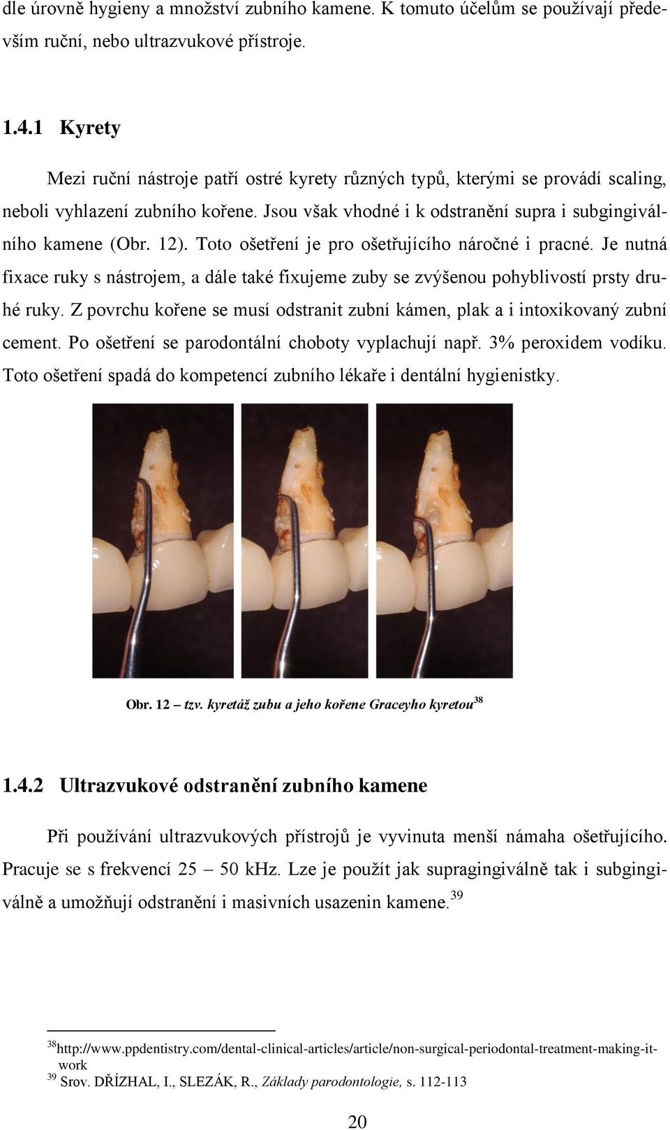 Toto ošetření je pro ošetřujícího náročné i pracné. Je nutná fixace ruky s nástrojem, a dále také fixujeme zuby se zvýšenou pohyblivostí prsty druhé ruky.