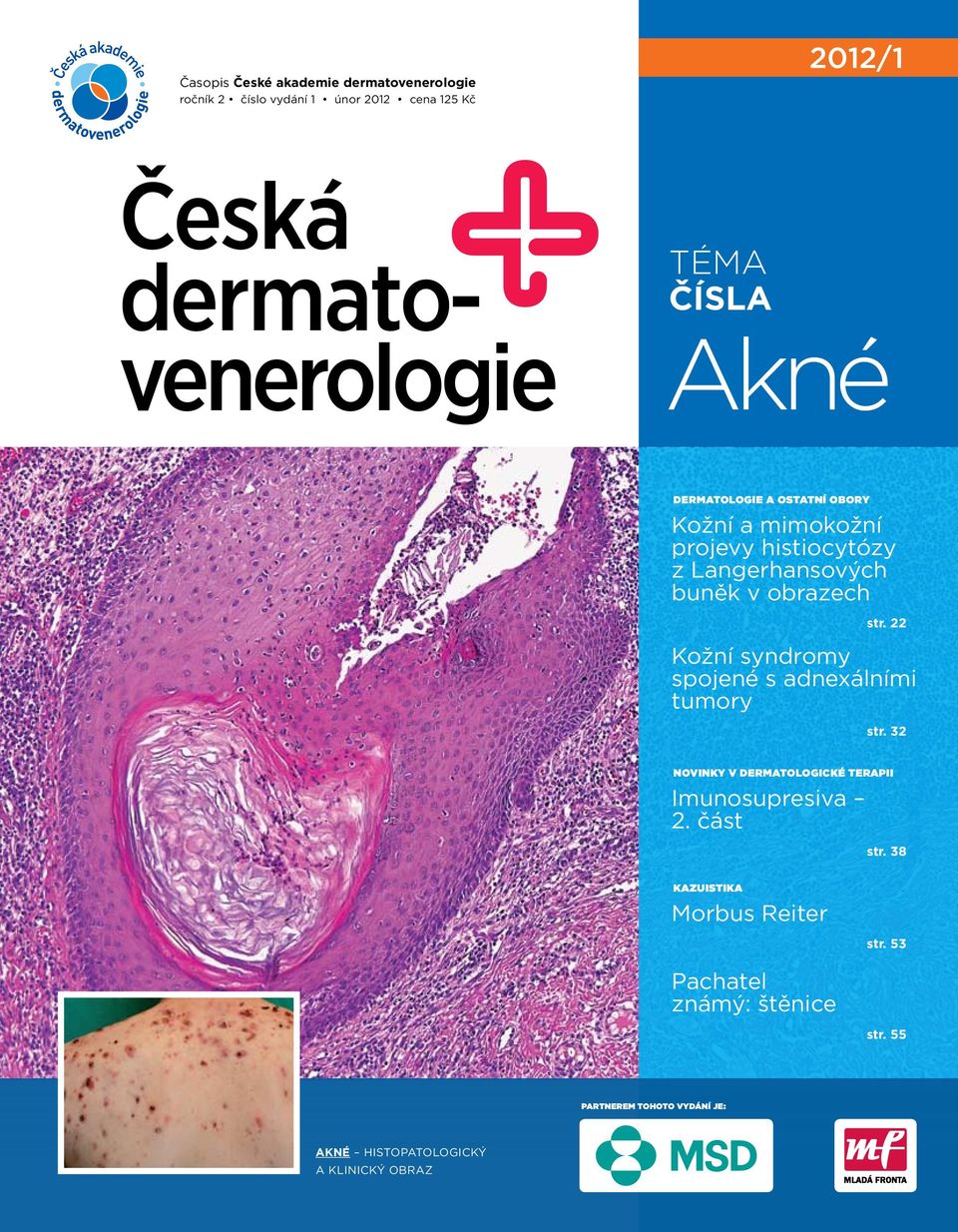 22 Kožní syndromy spojené s adnexálními tumory str. 32 Novinky v dermatologické terapii Imunosupresiva 2. část str.