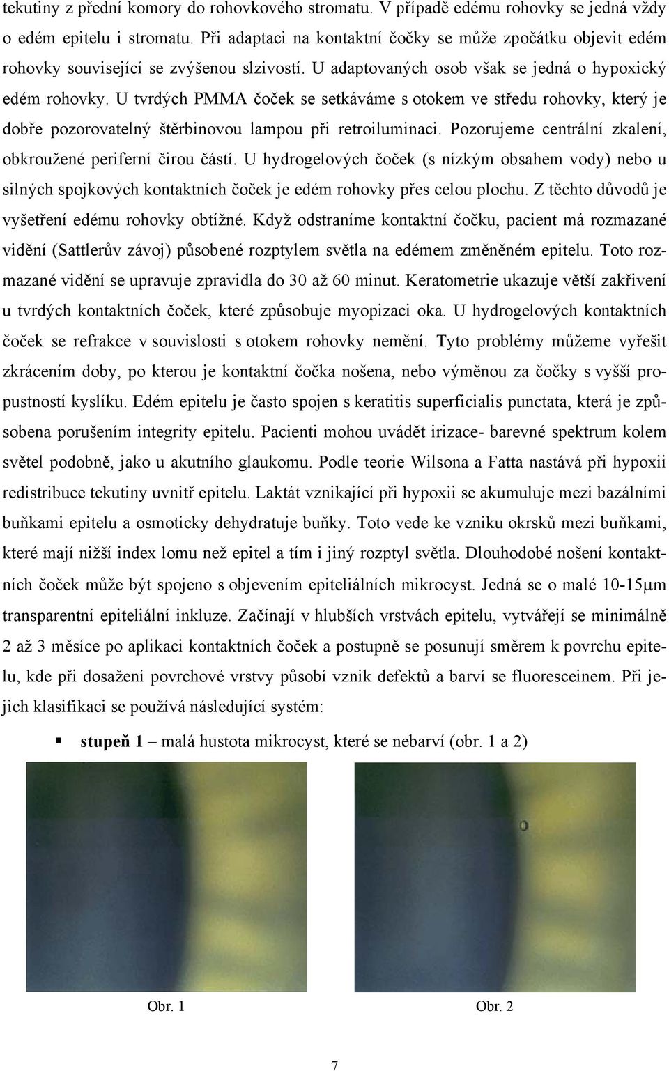 U tvrdých PMMA čoček se setkáváme s otokem ve středu rohovky, který je dobře pozorovatelný štěrbinovou lampou při retroiluminaci. Pozorujeme centrální zkalení, obkroužené periferní čirou částí.