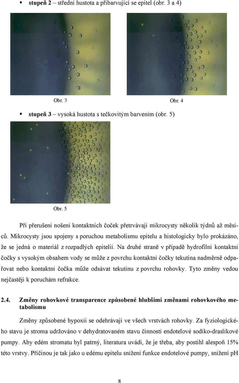 Mikrocysty jsou spojeny s poruchou metabolismu epitelu a histologicky bylo prokázáno, že se jedná o materiál z rozpadlých epitelií.