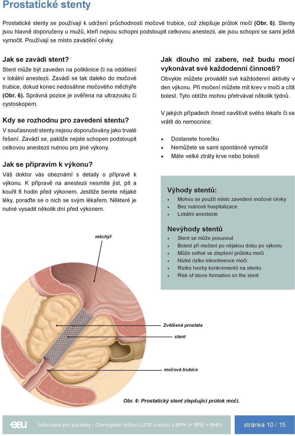 Stent může být zaveden na poliklinice či na oddělení v lokální anestezii. Zavádí se tak daleko do močové trubice, dokud konec nedosáhne močového e (Obr. 6).