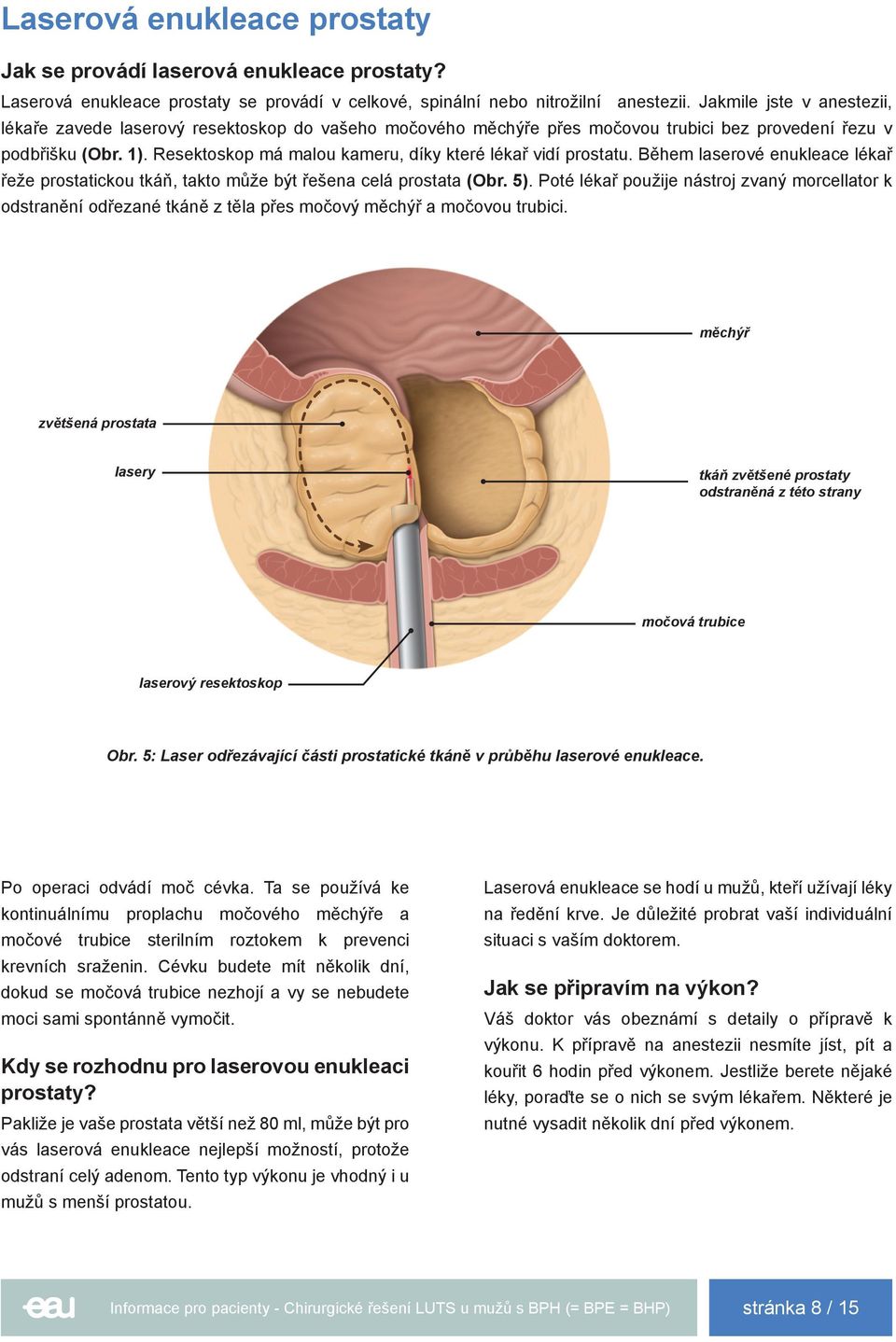 Resektoskop má malou kameru, díky které lékař vidí prostatu. Během laserové enukleace lékař řeže prostatickou tkáň, takto může být řešena celá prostata (Obr. 5).