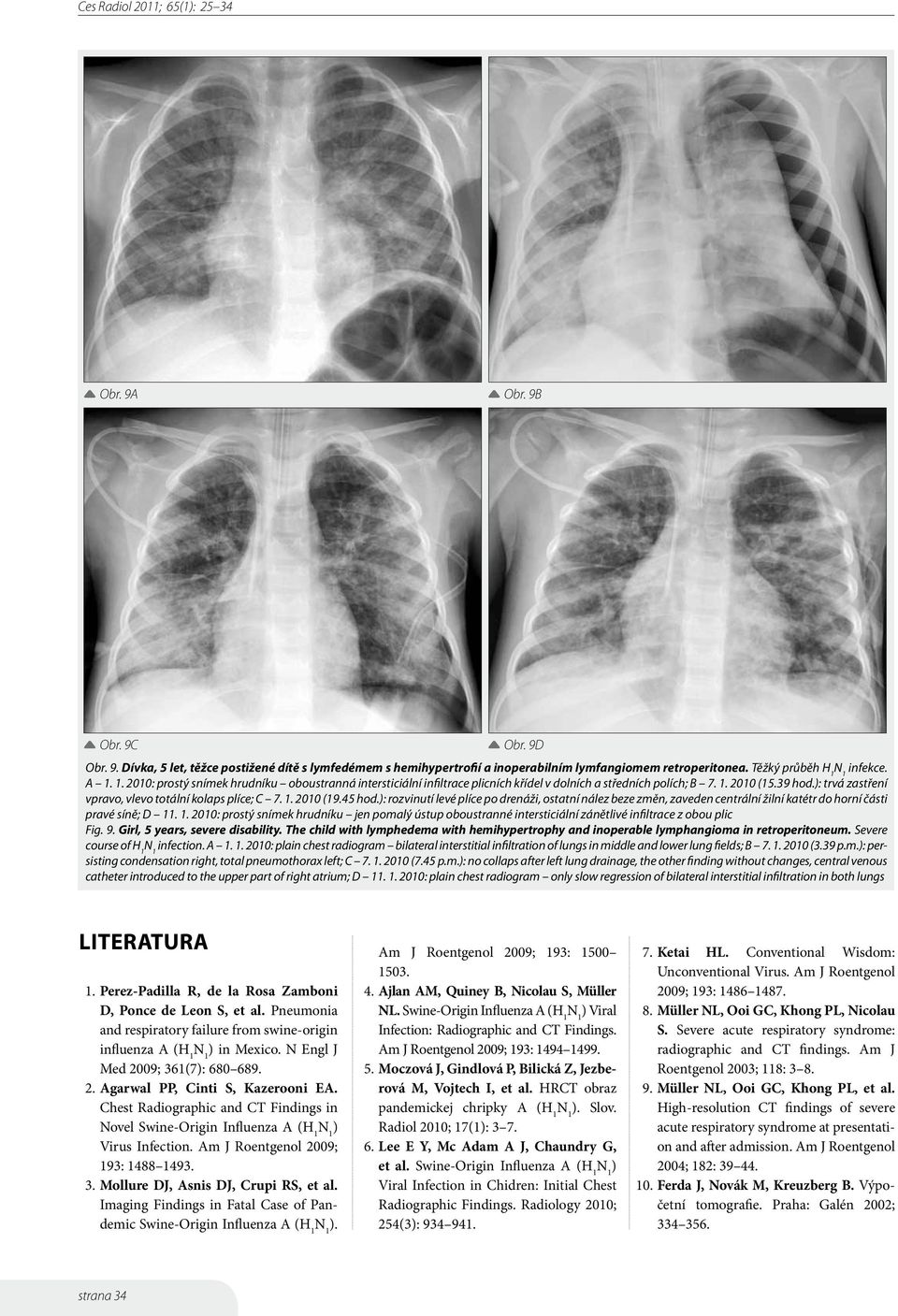 : trvá zastření vpravo, vlevo totální kolaps plíce; C 7. 1. 2010 (19.45 hod.: rozvinutí levé plíce po drenáži, ostatní nález beze změn, zaveden centrální žilní katétr do horní části pravé síně; D 11.