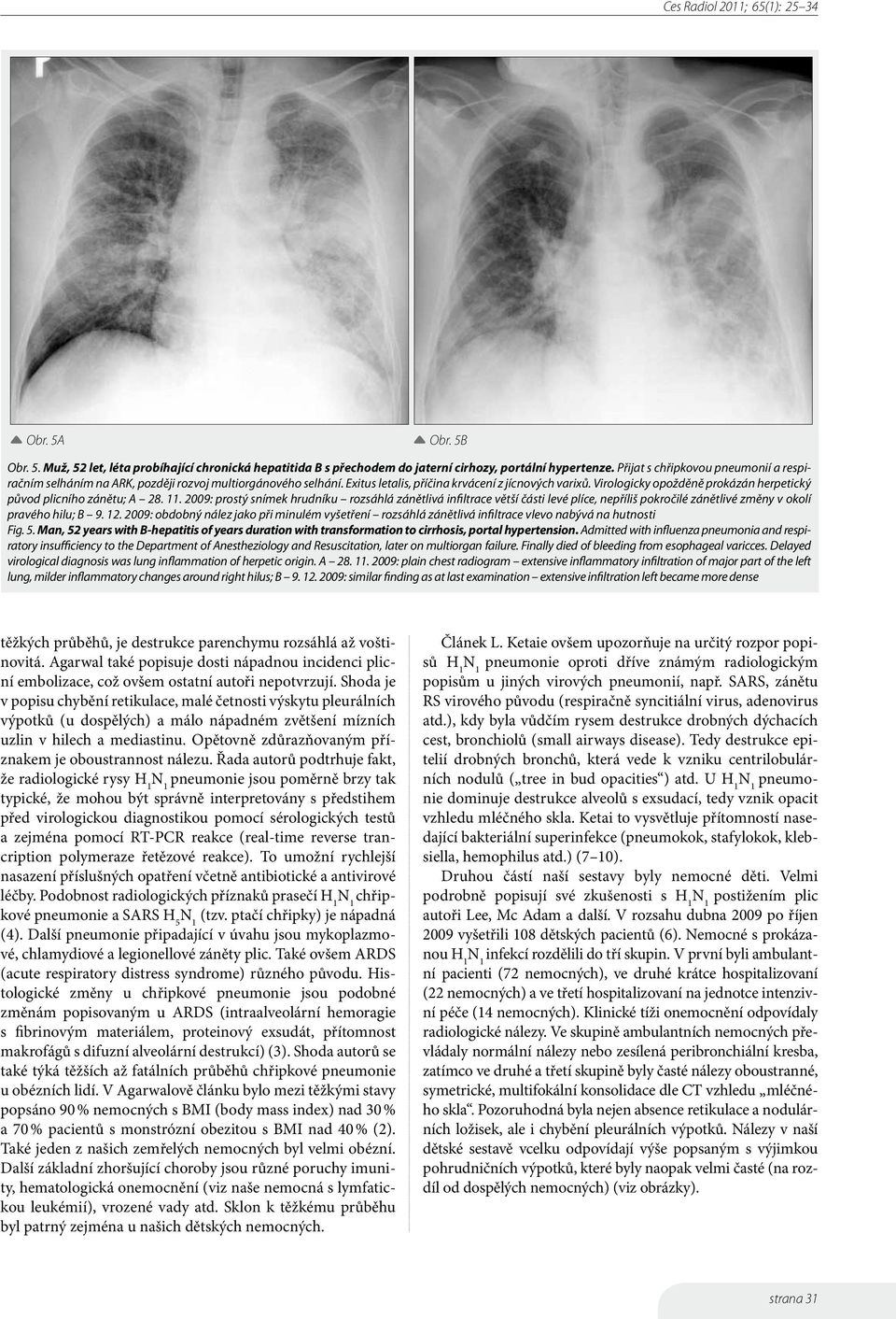 Virologicky opožděně prokázán herpetický původ plicního zánětu; A 28. 11.