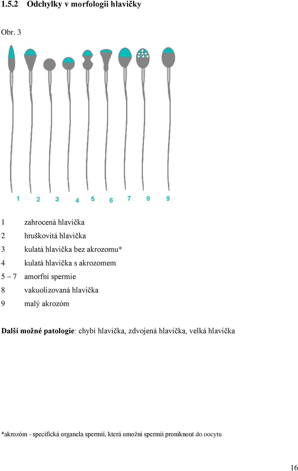 hlavička s akrozomem 5 7 amorfní spermie 8 vakuolizovaná hlavička 9 malý akrozóm Další