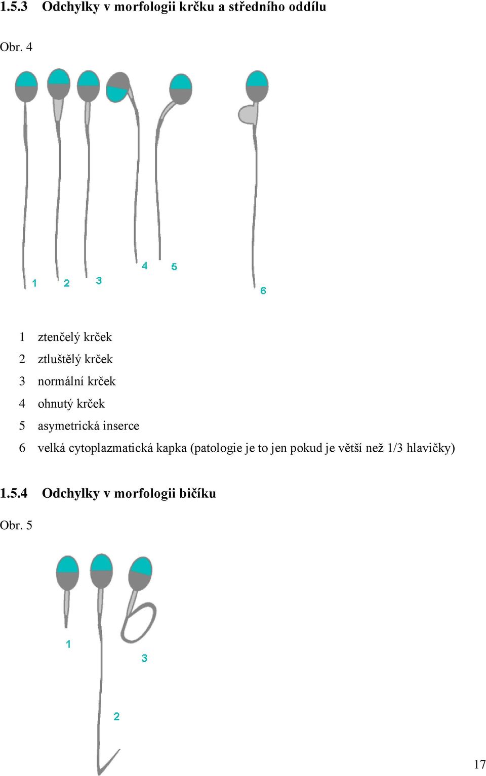 5 asymetrická inserce 6 velká cytoplazmatická kapka (patologie je to