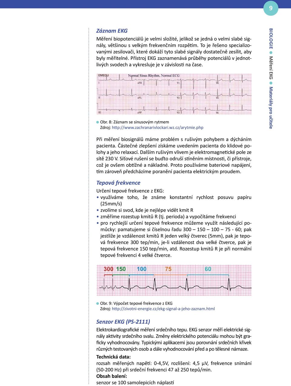 Přístroj EKG zaznamenává průběhy potenciálů v jednotlivých svodech a vykresluje je v závislosti na čase. Obr. 8: Záznam se sinusovým rytmem Zdroj: http://www.zachranarivlockari.wz.cz/arytmie.