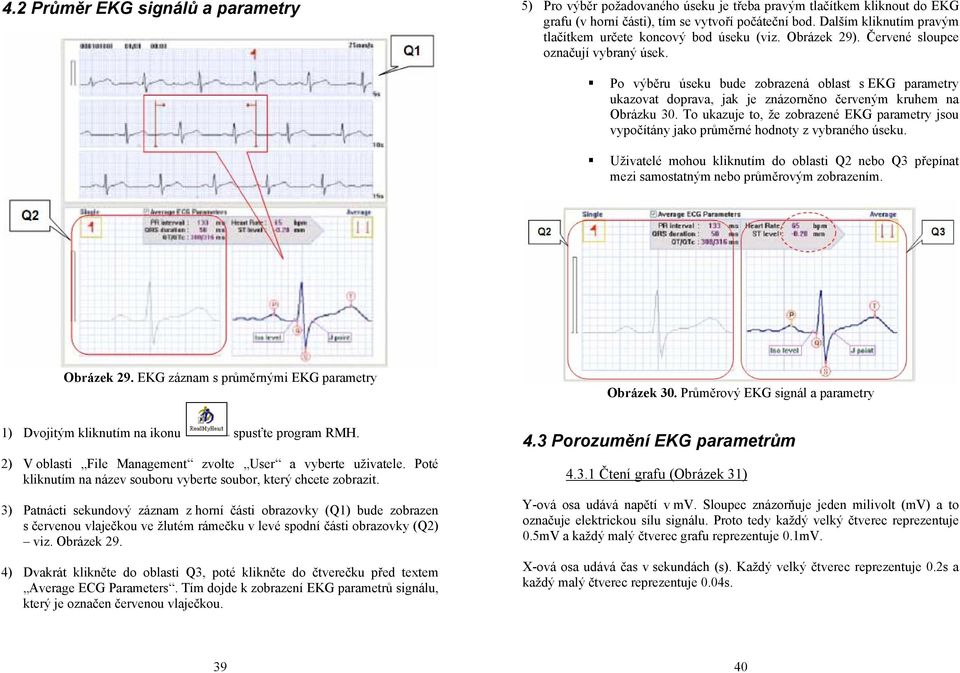 Po výběru úseku bude zobrazená oblast s EKG parametry ukazovat doprava, jak je znázorněno červeným kruhem na Obrázku 30.