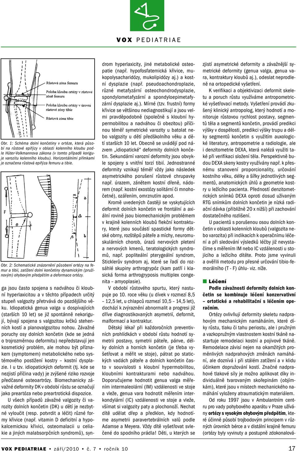 2: Schematické znázornění působení ortézy na femur a tibii, zatížení dolní končetiny dynamickým (pružinovým) ohybovým předpětím a deformace ortézy.