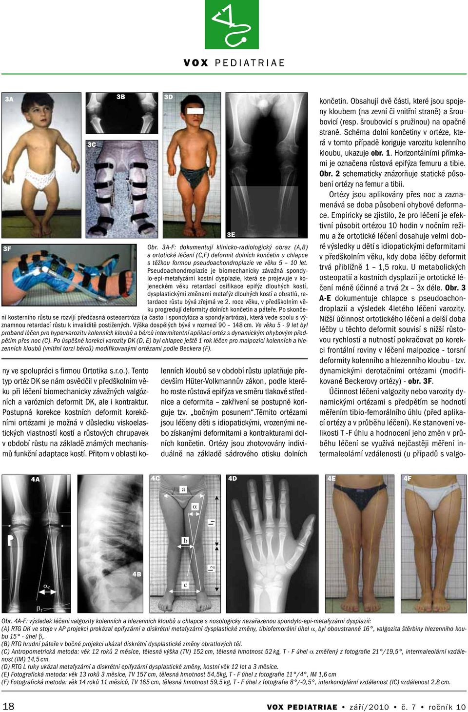 dlouhých kostí a obratlů, retardace růstu bývá zřejmá ve 2. roce věku, v předškolním věku progredují deformity dolních končetin a páteře.