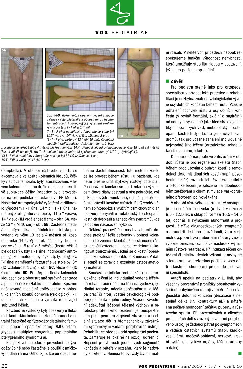 Epifýzeodéza či hemiepifýzeodéza s využitím osmičkových dlah nalezne jistě využití u metabolických osteopatií, kostních dysplazií a genetických syndromů, kde je obtížné načasování výkonu.