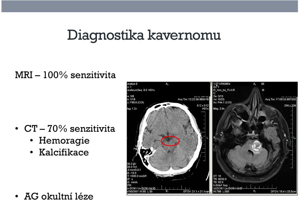 70% senzitivita