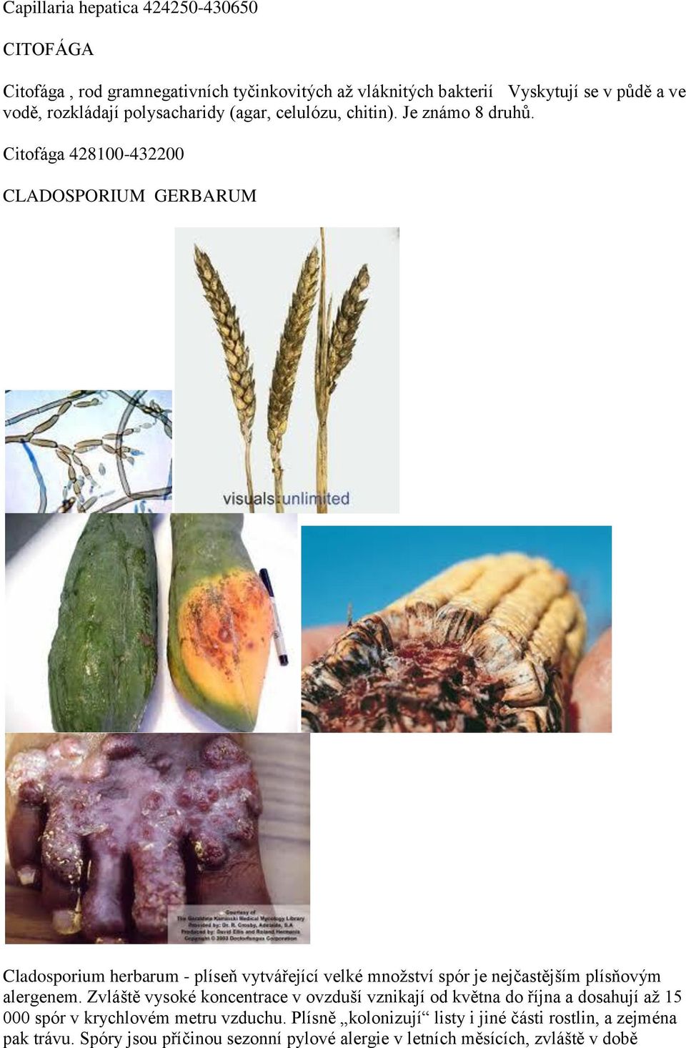 Citofága 428100-432200 CLADOSPORIUM GERBARUM Cladosporium herbarum - plíseň vytvářející velké mnoţství spór je nejčastějším plísňovým alergenem.