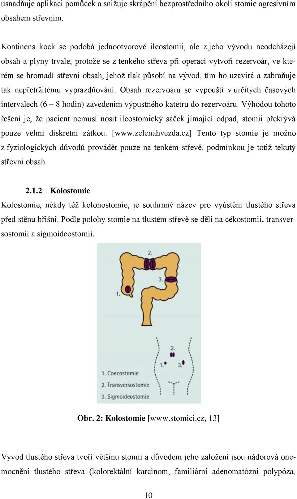 jehož tlak působí na vývod, tím ho uzavírá a zabraňuje tak nepřetržitému vyprazdňování.