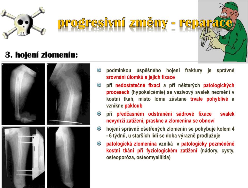 sádrové fixace nevydrží zatížení, praskne a zlomenina se obnoví svalek hojení správně ošetřených zlomenin se pohybuje kolem 4-6 týdnů, u starších lidí se