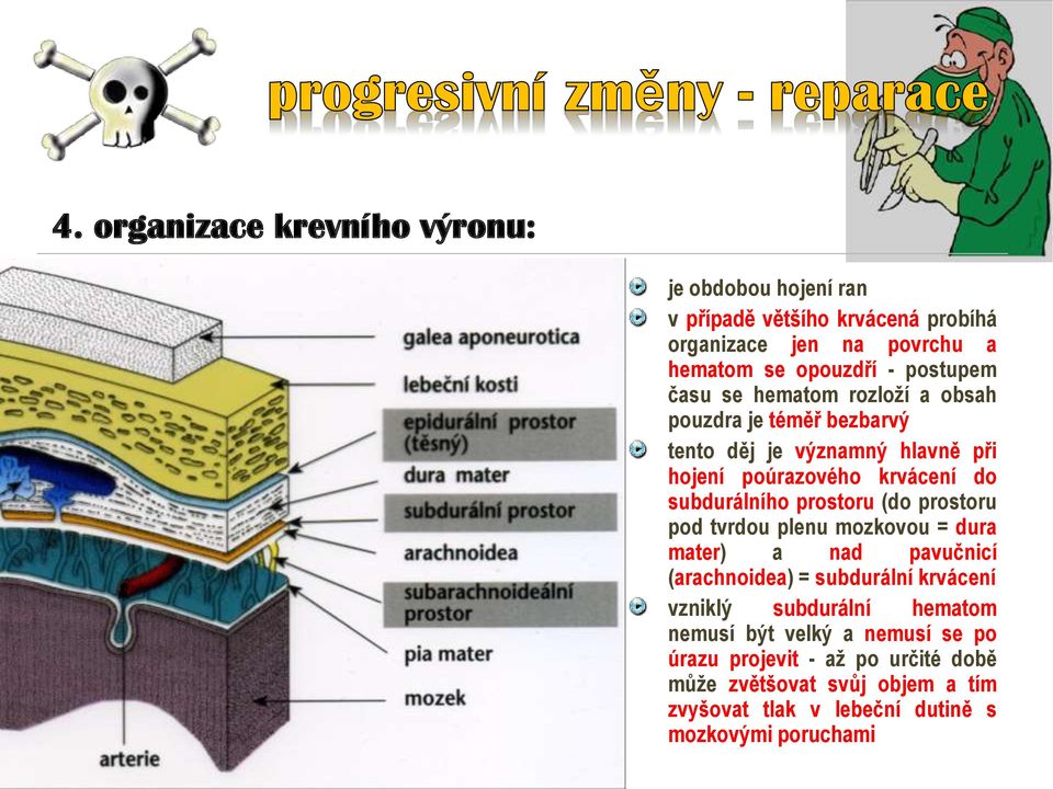 prostoru (do prostoru pod tvrdou plenu mozkovou = dura mater) a nad pavučnicí (arachnoidea) = subdurální krvácení vzniklý subdurální hematom