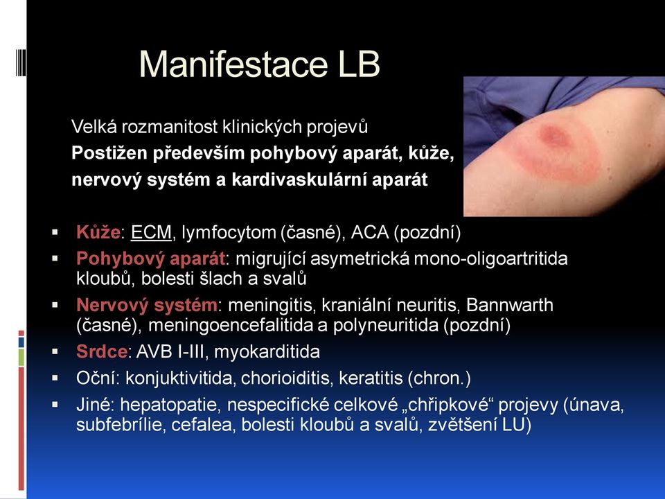 meningitis, kraniální neuritis, Bannwarth (časné), meningoencefalitida a polyneuritida (pozdní) Srdce: AVB I-III, myokarditida Oční: