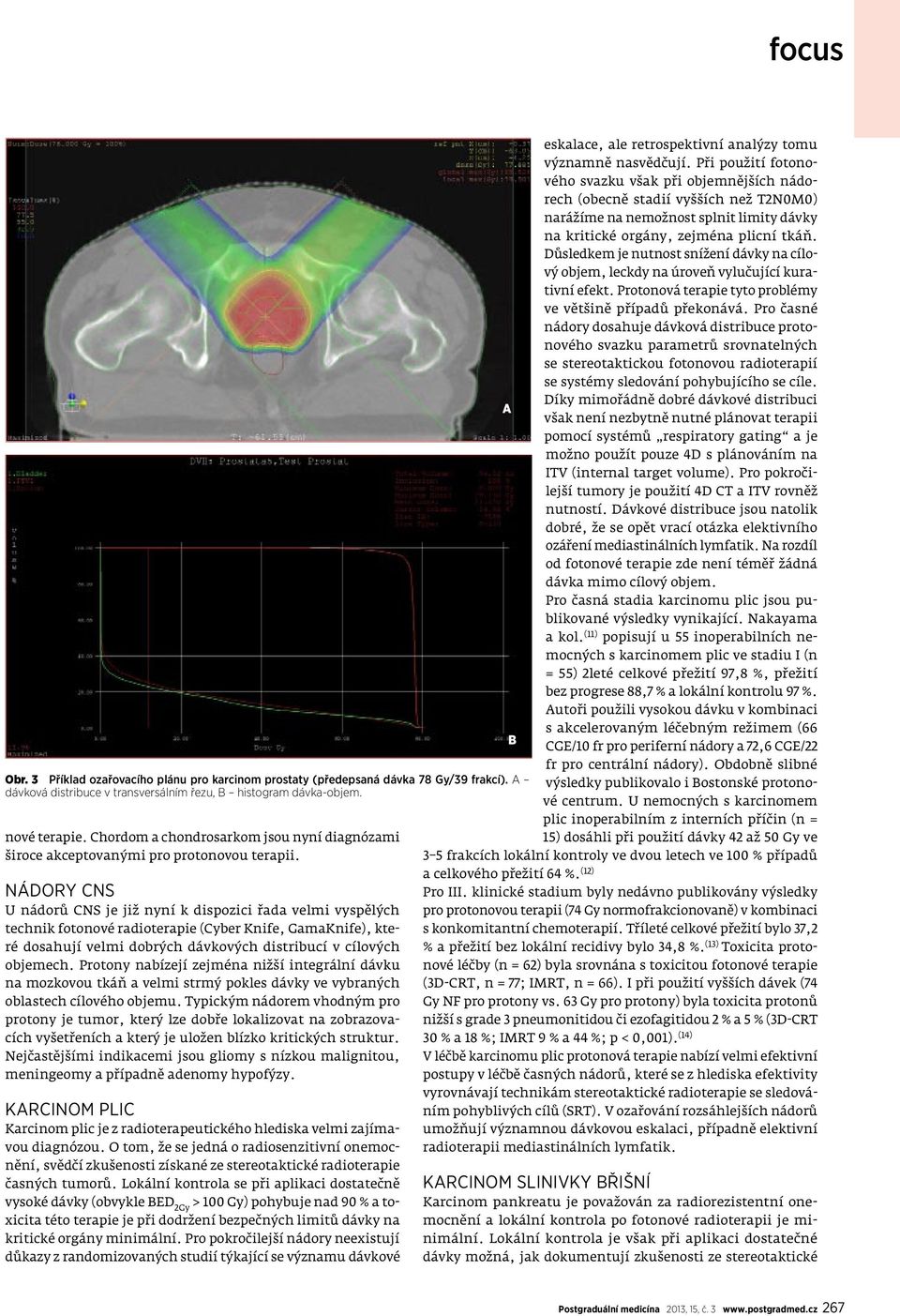 Nádory CNS U nádorů CNS je již nyní k dispozici řada velmi vyspělých technik fotonové radioterapie (Cyber Knife, GamaKnife), které dosahují velmi dobrých dávkových distribucí v cílových objemech.