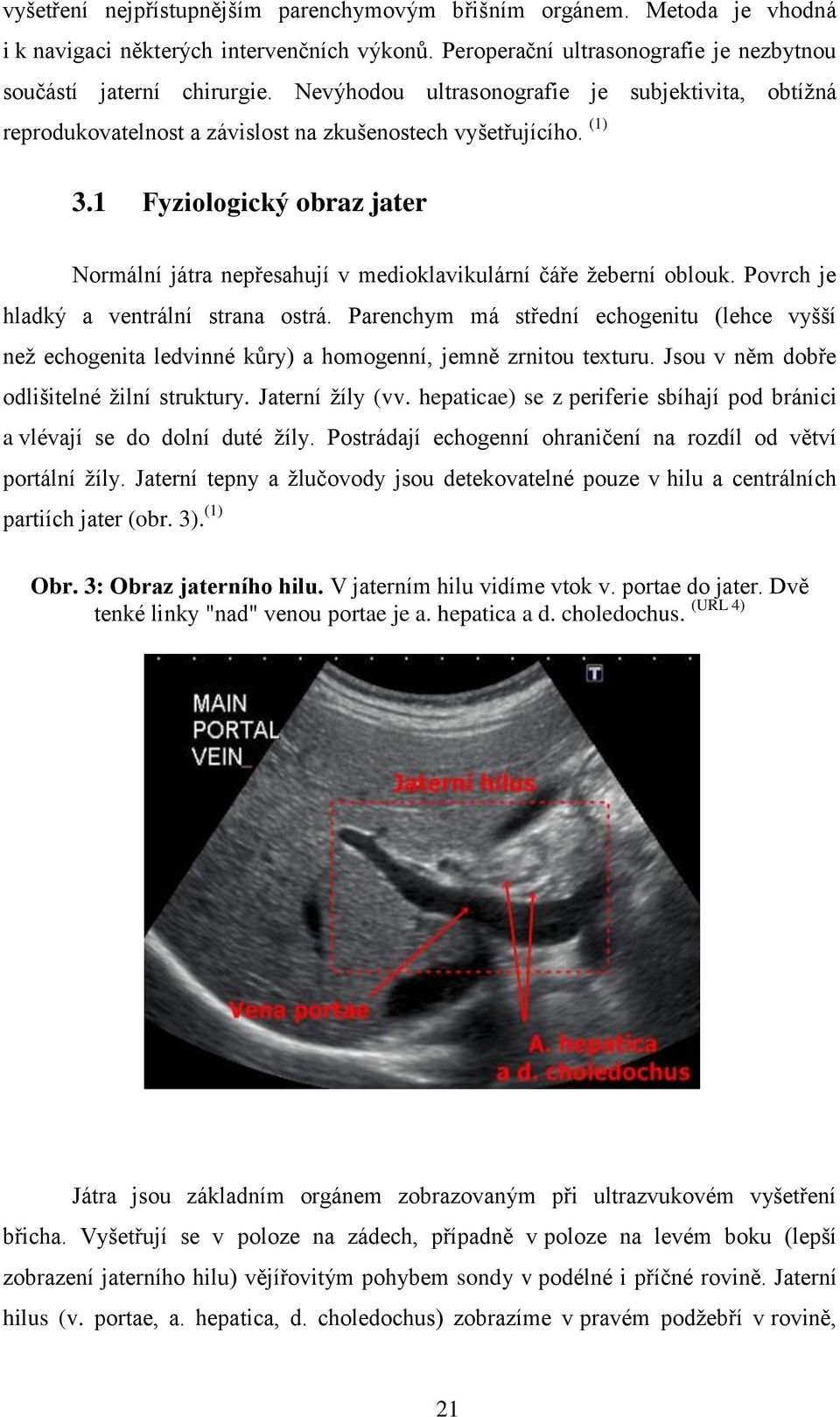 1 Fyziologický obraz jater Normální játra nepřesahují v medioklavikulární čáře žeberní oblouk. Povrch je hladký a ventrální strana ostrá.