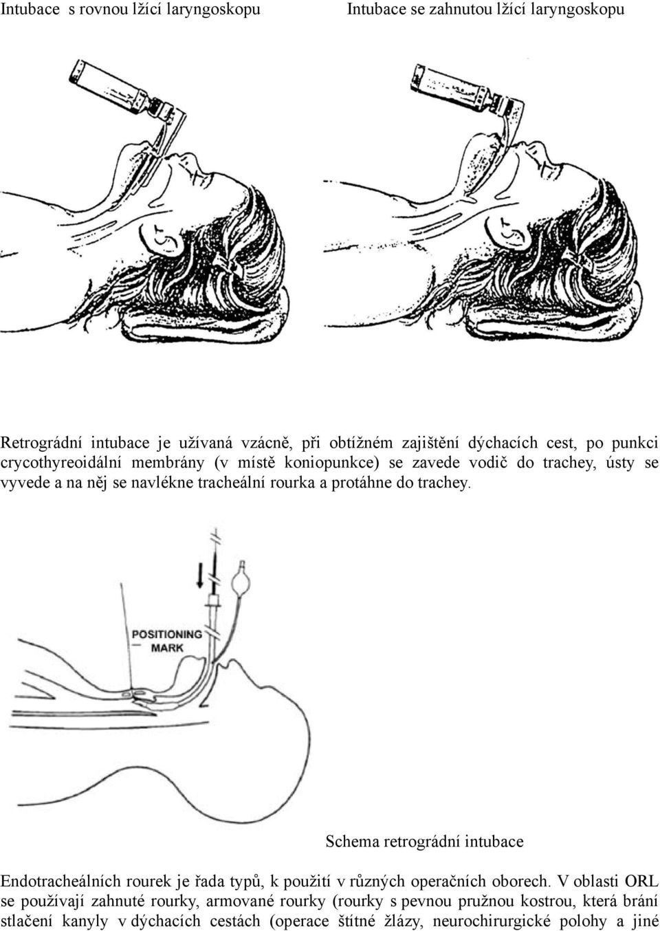 protáhne do trachey. Schema retrográdní intubace Endotracheálních rourek je řada typů, k použití v různých operačních oborech.