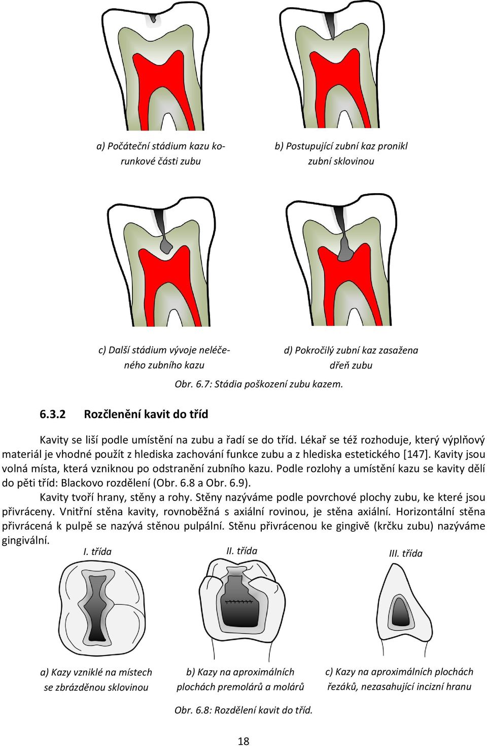 Lékař se též rozhoduje, který výplňový materiál je vhodné použít z hlediska zachování funkce zubu a z hlediska estetického [147]. Kavity jsou volná místa, která vzniknou po odstranění zubního kazu.
