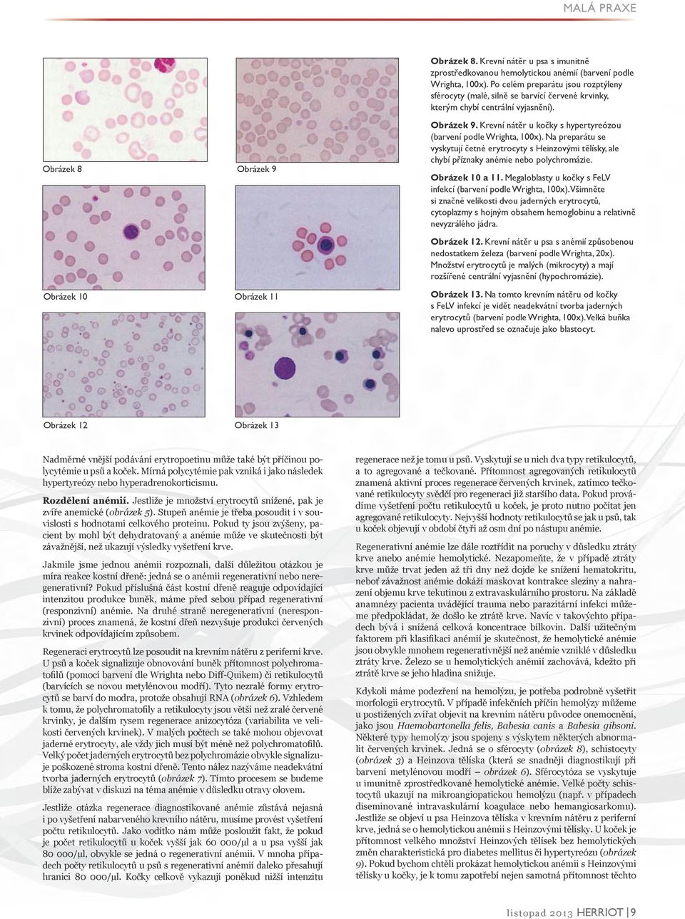 Na preparátu se vyskytují četné erytrocyty s Heinzovými tělísky, ale chybí příznaky anémie nebo polychromázie. Obrázek 10 a 11. Megaloblasty u kočky s FeLV infekcí (barvení podle Wrighta, 100x).