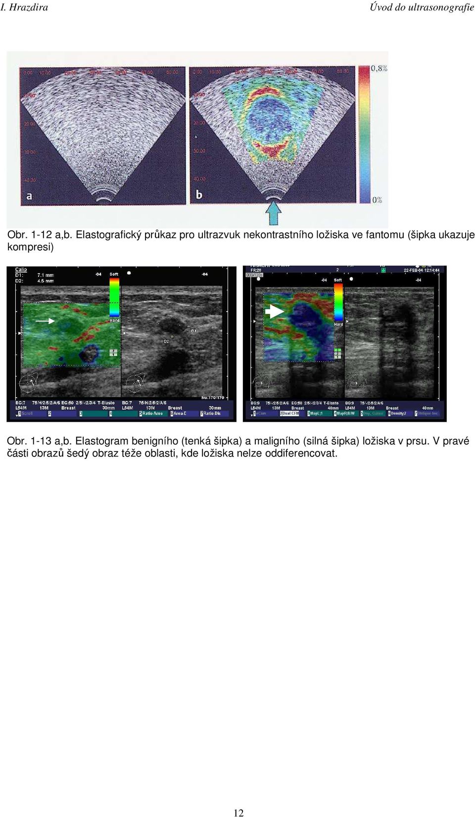 (šipka ukazuje kompresi) Obr. 1-13 a,b.