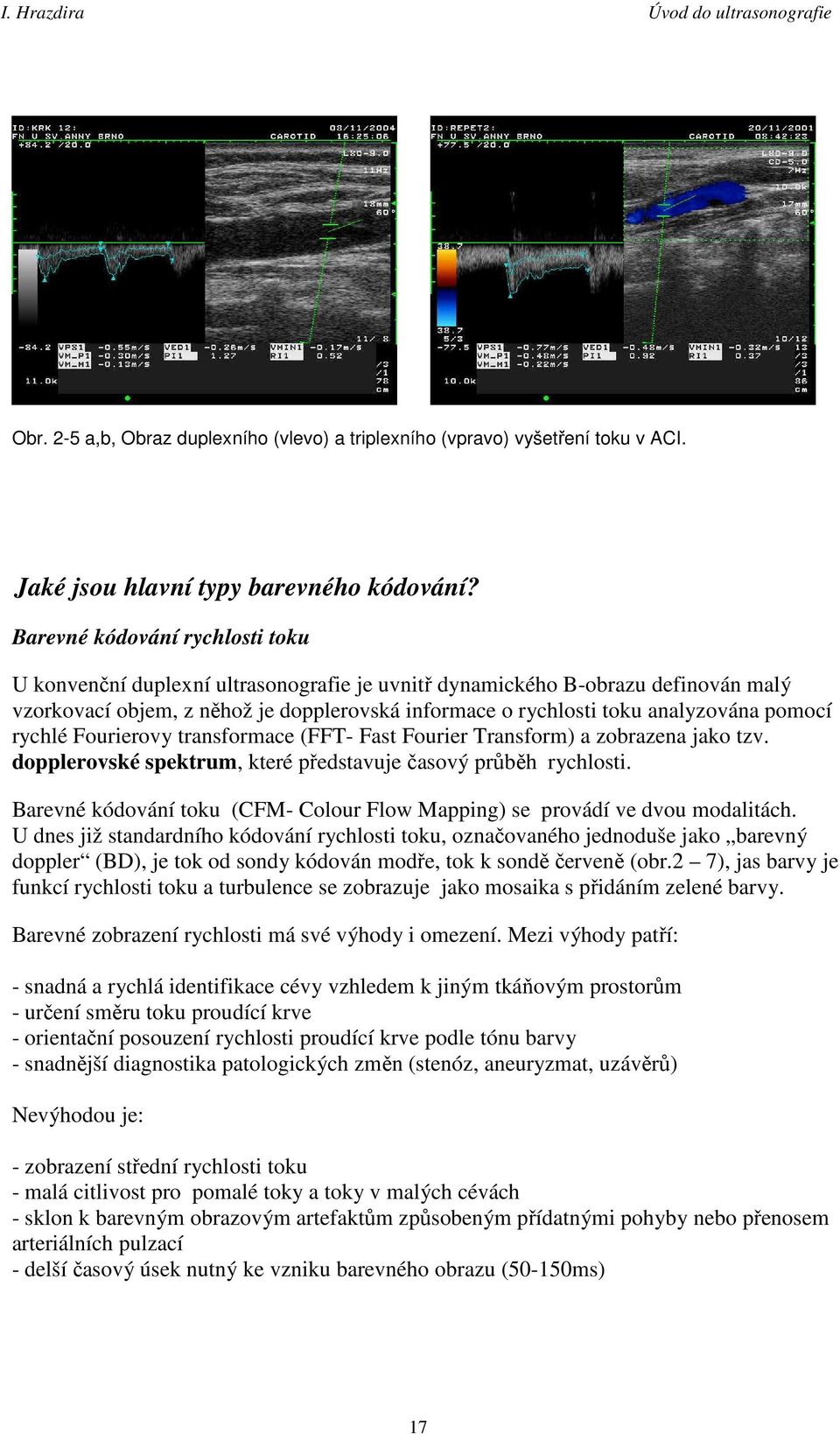 pomocí rychlé Fourierovy transformace (FFT- Fast Fourier Transform) a zobrazena jako tzv. dopplerovské spektrum, které představuje časový průběh rychlosti.