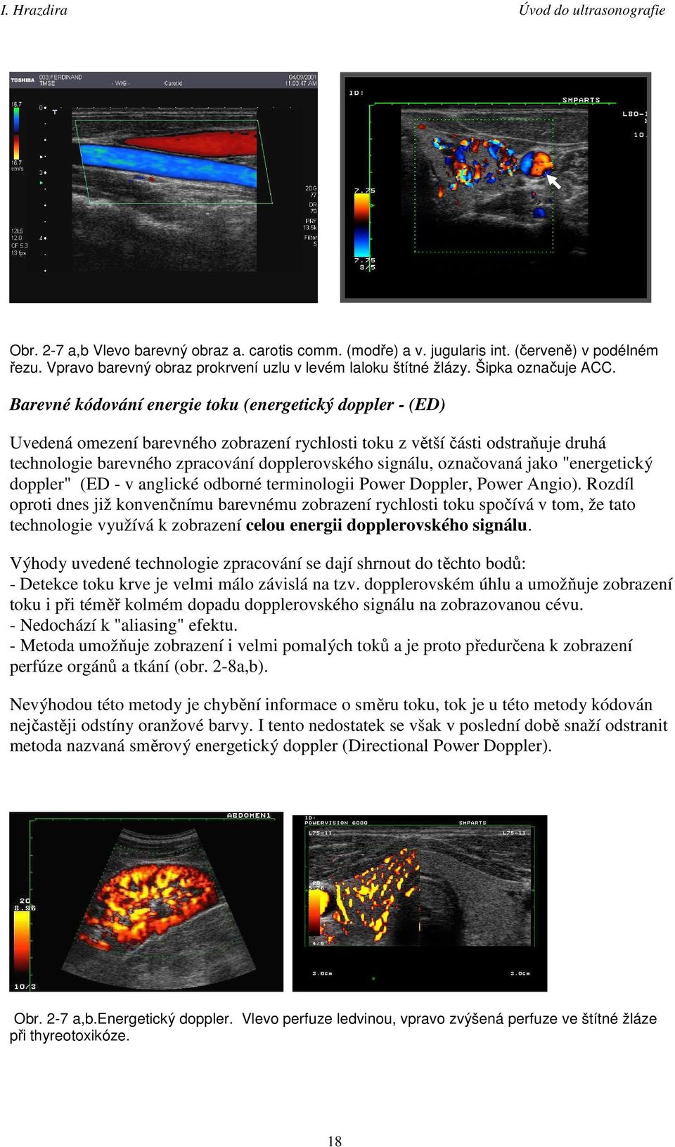 označovaná jako "energetický doppler" (ED - v anglické odborné terminologii Power Doppler, Power Angio).