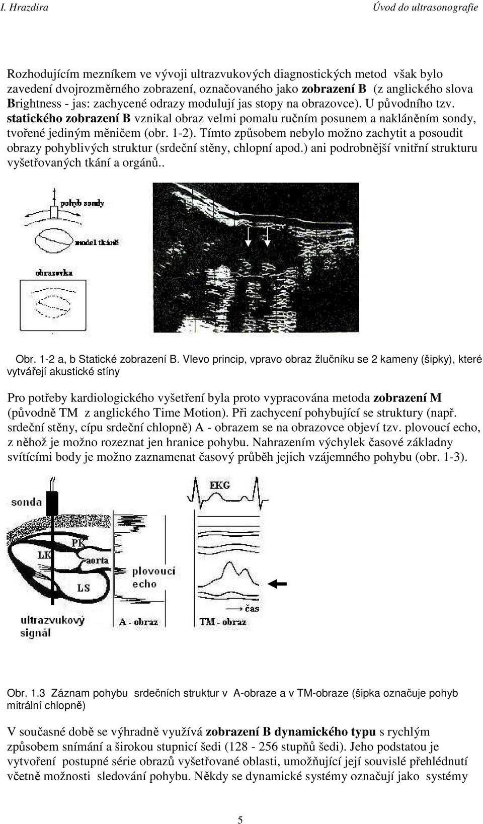 Tímto způsobem nebylo možno zachytit a posoudit obrazy pohyblivých struktur (srdeční stěny, chlopní apod.) ani podrobnější vnitřní strukturu vyšetřovaných tkání a orgánů.. Obr.